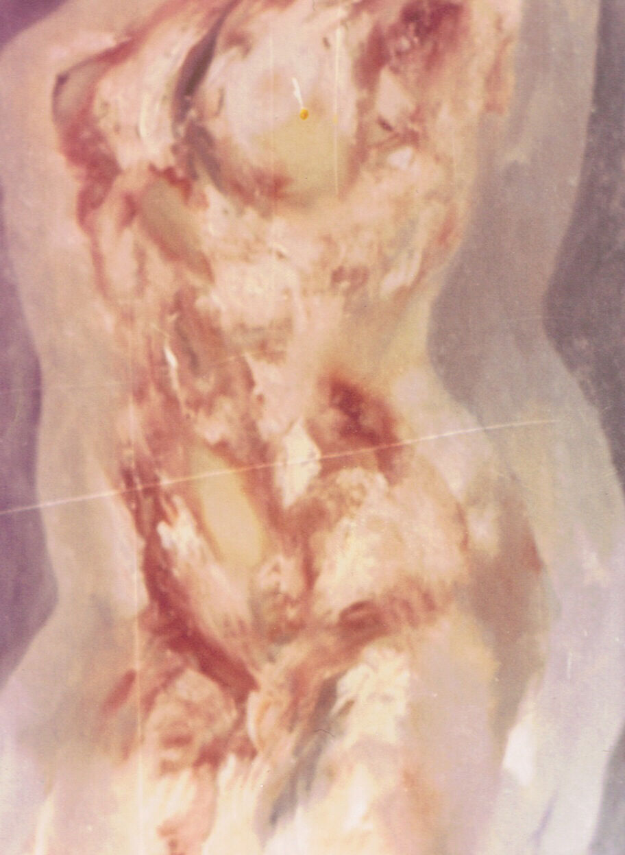 1971 torso